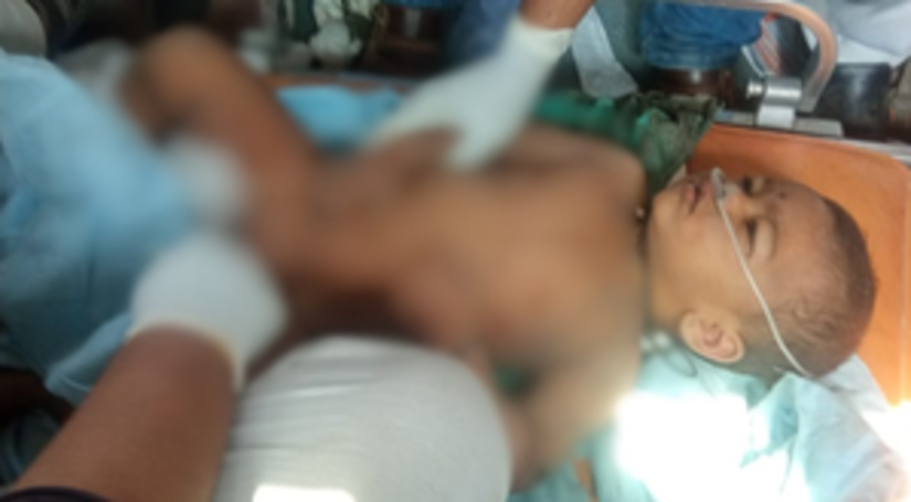 विजयपुरा में बोरवेल में गिरे दो साल के बच्चे को सुरक्षित निकाला गया