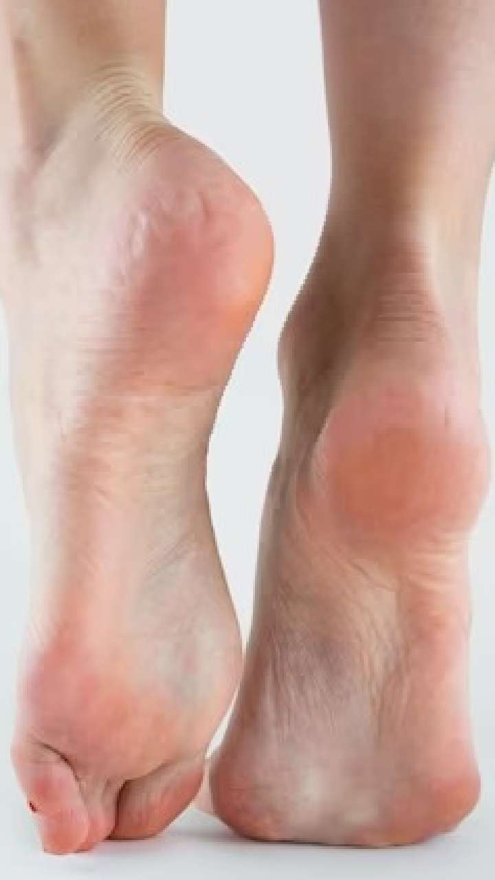 Home remedies for sale heel pain in hindi